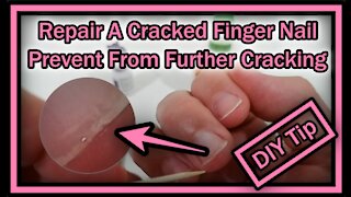 How To Repair A Cracked Or Split Finger Nail In Seconds And Prevent From Further Cracking?