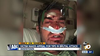 Victim makes appeal for tips in Gaslamp attack