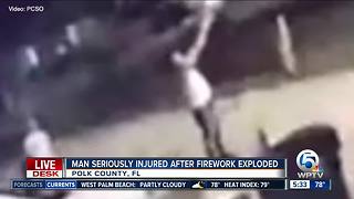 Florida man holding beer has firework explode in his hand