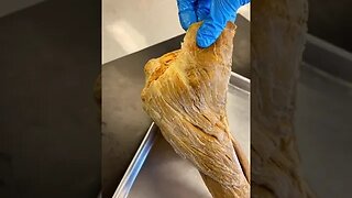 REAL Human Deltoid Muscle