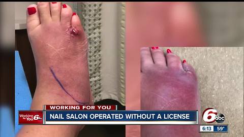 Nail salon where woman got infection did not have a license