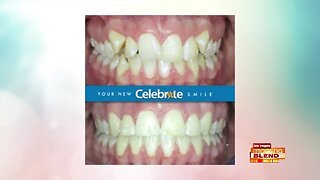 Celebrate a Perfect Smile Today