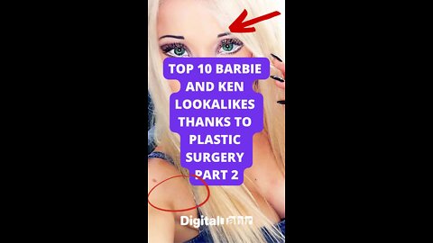 Top 10 Barbie and Ken Lookalikes thanks to Plastic Surgery Part 2