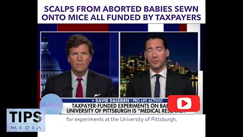 Dr Fauci's Office approved government research aborted fetal cells