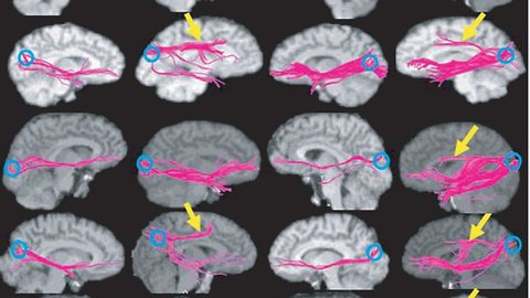 How Harmful Air Pollution Gets To Our Brains