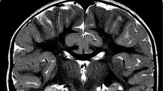 Neuroforensics Is Turning Our Brains Into Legal Evidence