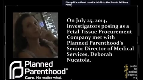Planned Parenthood uses partial-birth abortions to sell baby parts!! CAUGHT ON CAMERA (Dr. Nucatola)