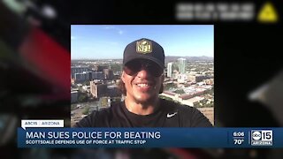 Man sues Scottsdale police for beating