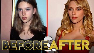 SCARLETT JOHANSSON | Before & After Transformation | Plastic Surgery, Diet, Fitness & more