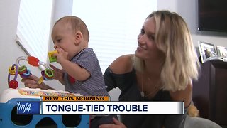 Extra tongue tissue provides challenge for doctors