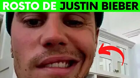 ROSTO JUSTIN BIEBER PARALISIA FACIAL