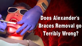 Does Alexander's Braces Removal Go Terribly Wrong?