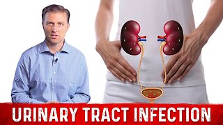Best Home Remedy for Urinary Tract Infection (UTI) – Dr. Berg