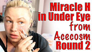 OLD VIDEO RESHARE Miracle H in Under Eyes: Build Collagen! AceCsom, Code Jessica10 Saves you Money