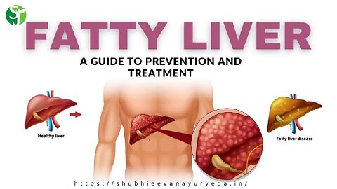 Liver Care Home Remedies | Fatty Liver Problem Sahi Karne ke Gharelu Upay | लिवर को कैसे ठीक करें