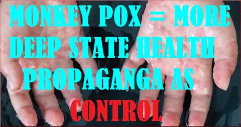 MONKEY POX = MORE DEEP STATE HEALTH PROPAGANDA AS CONTROL