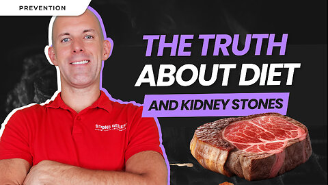 Live Q/A | Diet's Impact on Kidney Stones