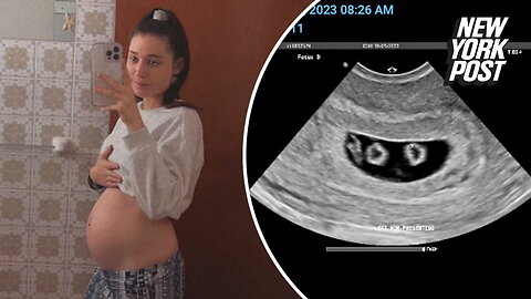 First time mom is pregnant with two sets of identical twins