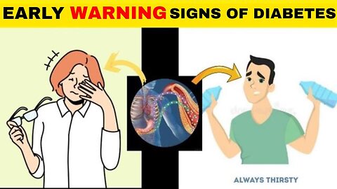 Early Warning Signs Of Diabetes | Diabetes Symptoms | Signs Of Diabetes