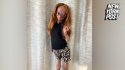 YouTuber Adalia Rose Williams dead at 15: 'She is no longer in pain'