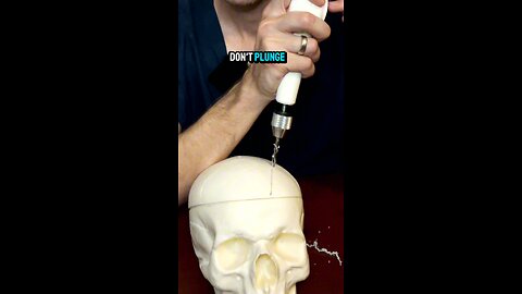 How neurosurgeons drill into the skull