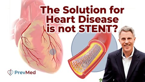 This is Why Stent is Not Always The Solution for Heart Disease