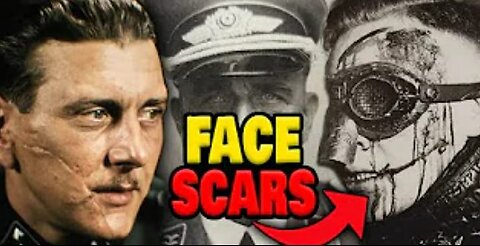 Why Did High-Ranking Nazis Have Face Scars?