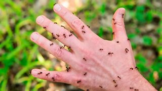 How To Treat Ant Bites Naturally