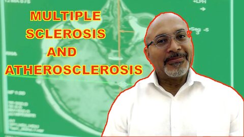 (MS) Multiple Sclerosis and Atherosclerosis
