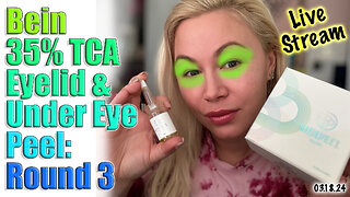 Previously Live Tighten Hooded Eye Lids & Under Eyes w/ Bein 35% TCA Peel, AceCosm | Code Jessica10
