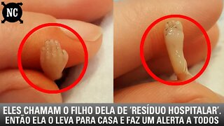 Eles Chamam O Filho Dela De ‘Resíduo Hospitalar’. Então Ela O Leva Para Casa E Faz Um Alerta A Todos