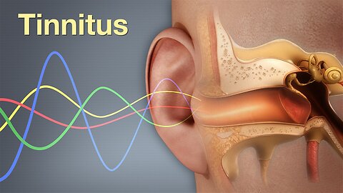 Root Cause Of Tinnitus: We Can Hear Electricity?