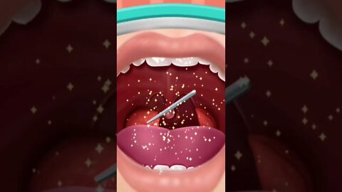 removal of Tonsils Part #3 #shorts #doctor #games