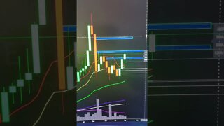 Bitcoin & Ethereum London Hard Fork Price Action Update. #Shorts