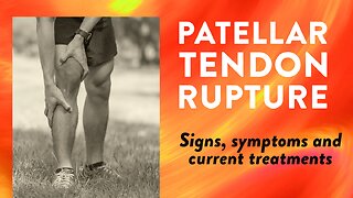 Patellar tendon rupture: Signs, symptoms and current treatments