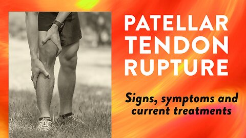 Patellar tendon rupture: Signs, symptoms and current treatments