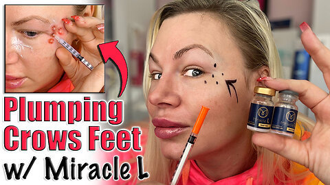 Plumping Crows Feet with Miracle L! AceCosm.com | Code Jessica10 Saves you money!