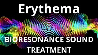 Erythema _ Sound therapy session _ Sounds of nature