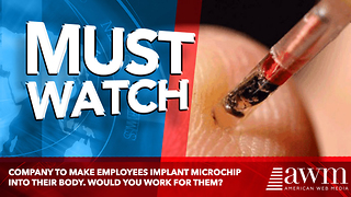 Company To Make Employees Implant Microchip Into Their Body. Would You Work For Them?