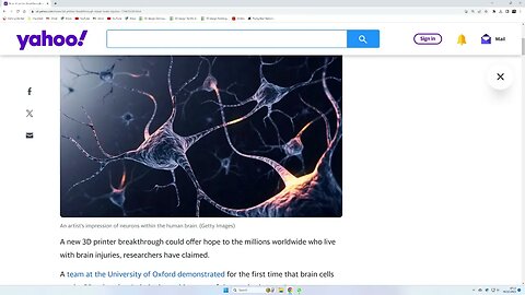 Repair a brain using a 3D printer