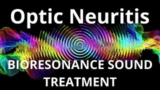 Optic Neuritis_Sound therapy session_Sounds of nature