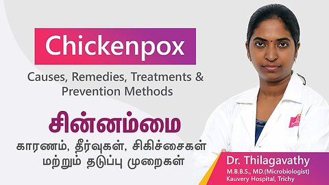 Chicken Pox - Symptoms, Causes, Prevention, Treatment & Awareness
