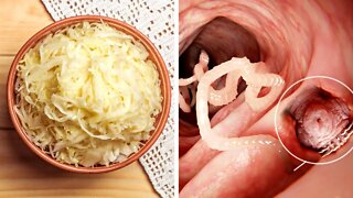 Eat These Foods To Sweep Parasites Out of Your Intestines