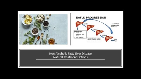 Non Alcoholic Fatty Liver Disease - Natural Treatment