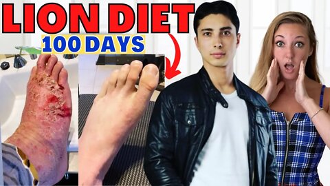 Lion Diet Reverses Eczema NATURALLY! (How a Carnivore Diet COMPLETELY Healed INCURABLE Skin Disease)