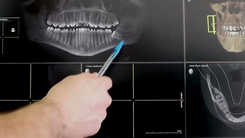 OG Dental 3D Tomography