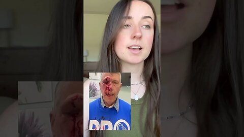 Pro-Life Man ATTACKED By Pro-Choice Activist