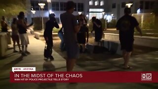 Valley photographer injured in Phoenix protest released from hospital