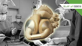 Stuff of Genius: Robert Jarvik: The Artificial Heart