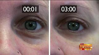 Getting Rid of Under Eye Bags in Minutes!